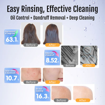 Profesjonalna maszyna Micro Nano Bubble Spa Generator Nanobubble wodoru do odmładzania skóry, nawodnienia i zabiegów anty-aging